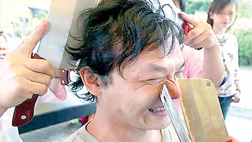 ٹوکا تھراپی:خطرناک بیماریوں سے چھٹکارے کا طریقہ علاج