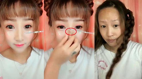 سرجری کے بغیر ناک کی بناوٹ میں تبدیلی کا طریقہ مقبول