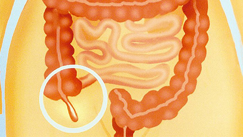  اپینڈکس سمیت انسانی جسم کے 6حصے کسی کام کے نہیں 