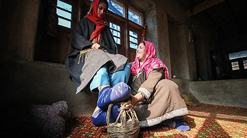 لمفیٹک فیلارسیز نامی مرض سے خاتون کے پیر سوج کر ہاتھی جتنے ہوگئے