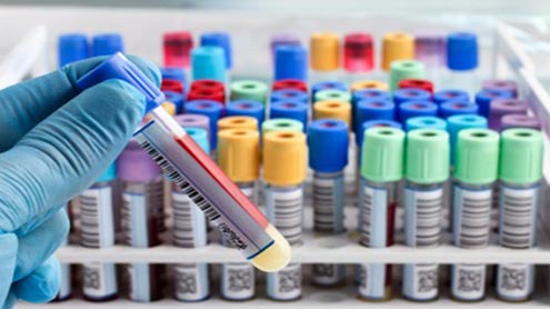  بیماری کے بیکٹیریا کی آوازسننا ممکن 