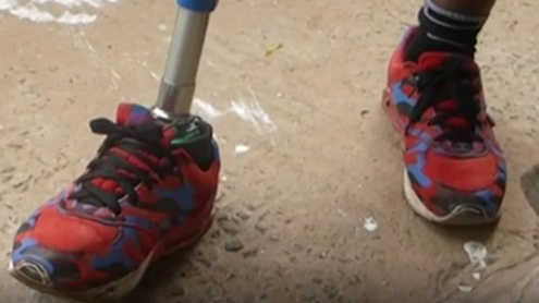 برطانوی سائنسدان نے معذروں  کیلئے سستی مصنوعی ٹانگ تیار کرلی 