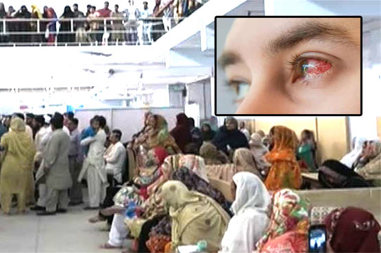 آشوب چشم: مریضوں کی تعداد دگنی، ہسپتالوں میں رش 