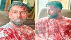 رنبیر کپور کی خون آلود کپڑوں میں تصاویرسوشل میڈیا پر وائرل