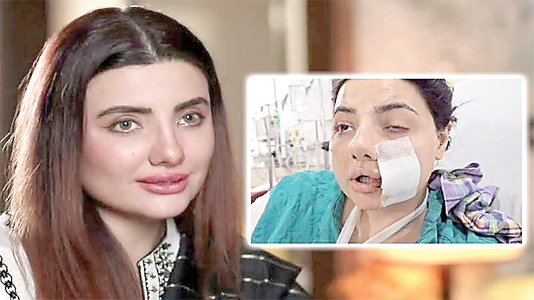 زخمی سابقہ اداکارہ زینب جمیل نے  آئی جی پنجاب سے مدد مانگ لی