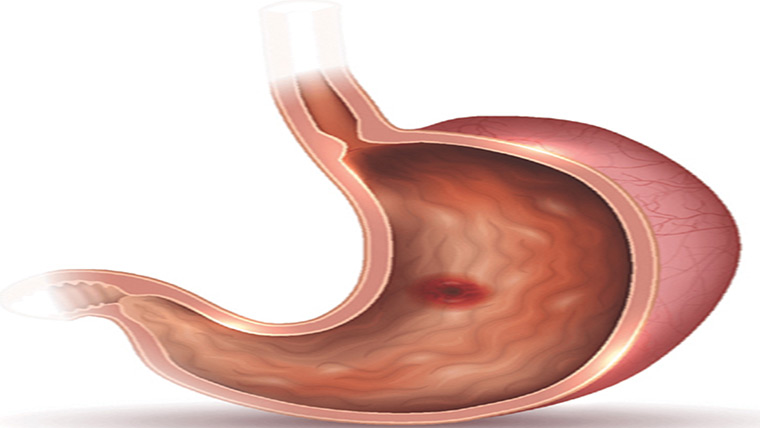 54مریض ہسپتالوں میں داخل