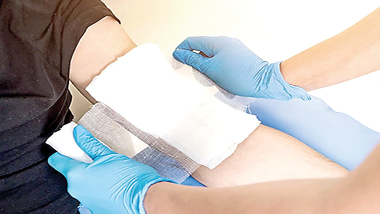 جلے ہوئے زخموں کو ٹھیک کرنے کیلئے جادوئی پٹی تیار