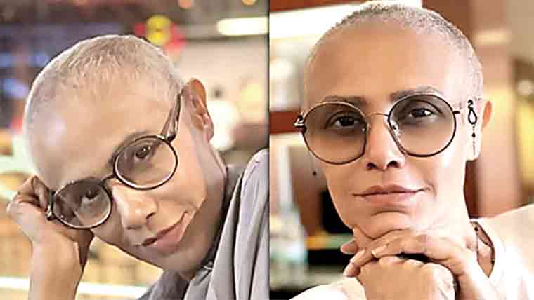 خوبصورتی مسکراہٹ اور بالوں کے  بغیر سر سے بھی جھلکتی ہے :انجلین ملک