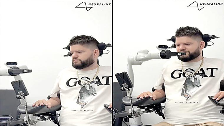 دماغ کی مدد سے روبوٹک بازو کامیابی کیساتھ استعمال 