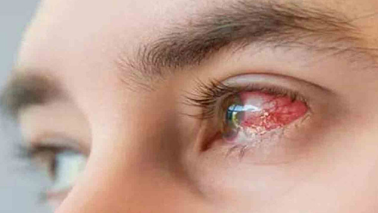 آفتھلمولوجیکل سوسائٹی کی  امراض چشم کی سالانہ کانفرنس