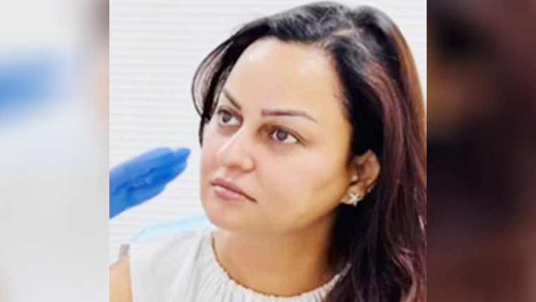 جویریہ عباسی کی اینٹی ایجنگ  علاج کی ویڈیو وائرل 