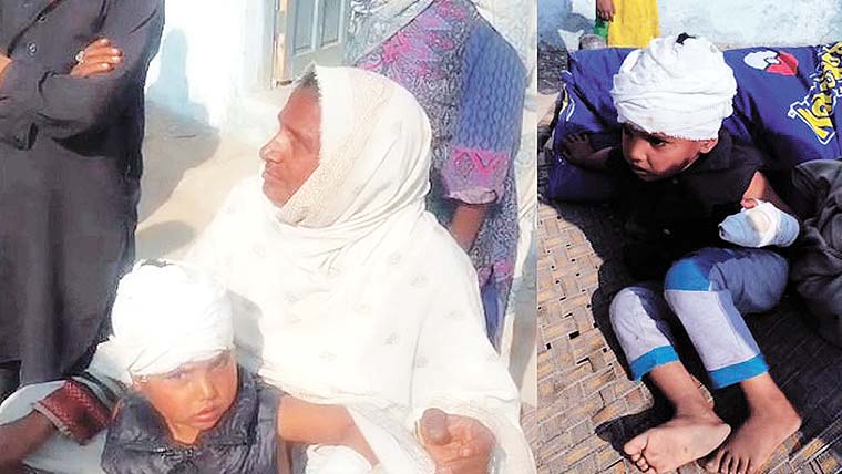 کتے کے کاٹنے سے بچہ زخمی  ،2مالکان کوگرفتار کر لیا گیا 