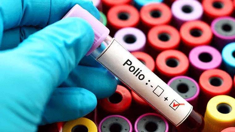 ملک کے 46مقامات کے ماحولیاتی نمونوں میں پولیو وائرس کی تصدیق
