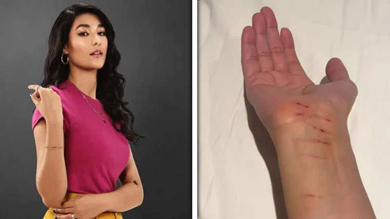 کنسرٹ کے دوران شائے گل  حادثے کا شکار، ڈرون لگنے سے زخمی