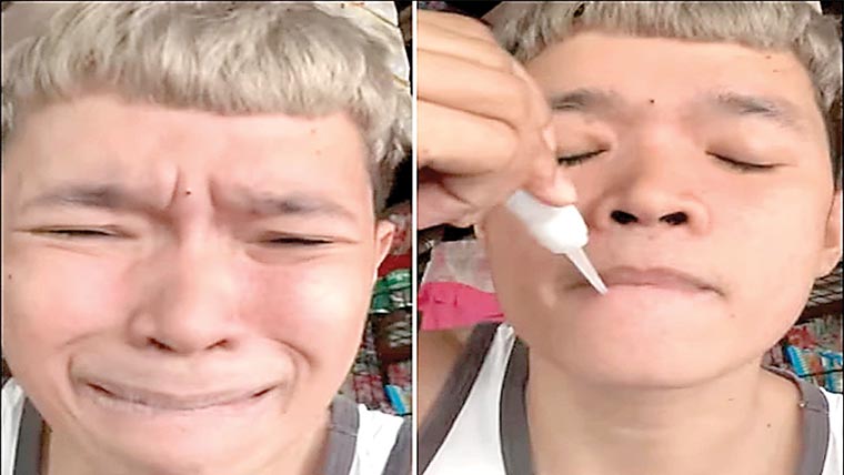 سپر گلو سے ہونٹ چپکانے کا مذاق مہنگا پڑ گیا، ویڈیو وائرل