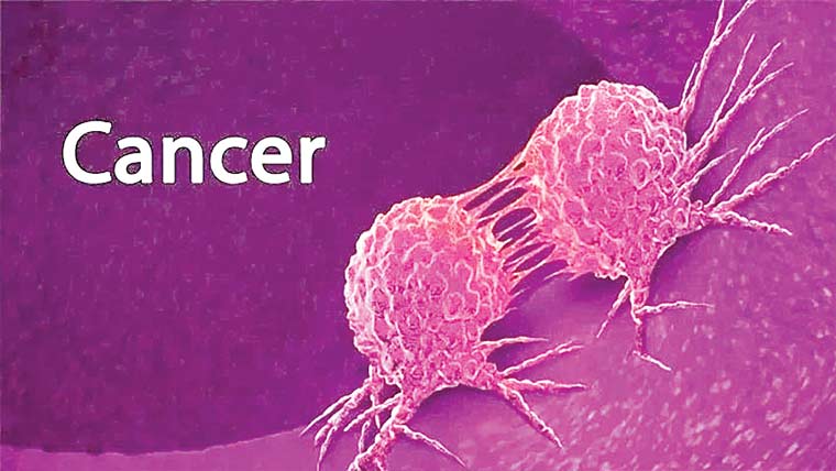 تمباکو نوشی نہیں فضائی آلودگی پھیپھڑوں کے کینسر کی بڑی وجہ