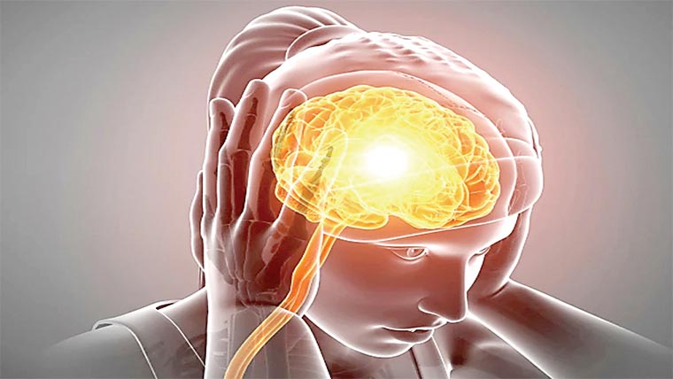 موسمیاتی تبدیلیاں مائیگرین کا سبب بن سکتی ہیں:تحقیق