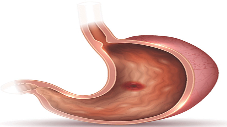 65مریض رپورٹ