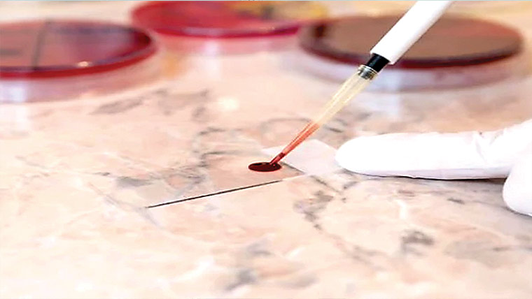 خون ٹیسٹ سے متعدد کینسرز کا قبل از وقت پتہ لگایا جاسکتا 