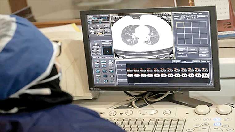 سگریٹ نہ پینے والوں میں کینسر شناخت کرنیوالا ماڈل