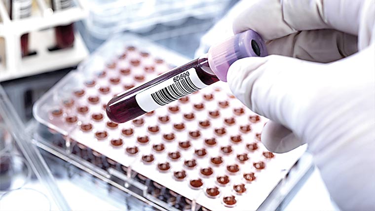 کینسر کب ہوگا ،پتا چلانے کیلئے ڈی این اے ٹیسٹ تیار