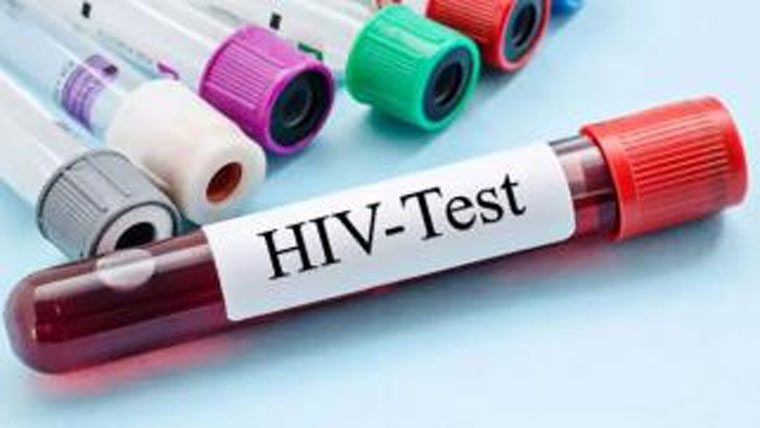 ایڈز کا خطرہ سنگین، ملک کے 54 فیصد مریض پنجاب سے نکلے : رپورٹ 