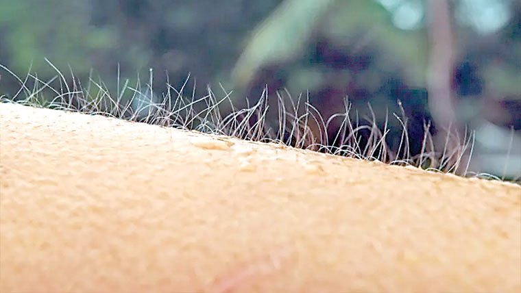 ڈر یا جوش میں رونگٹے کیوں کھڑے ہو جاتے ہیں 