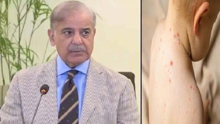  منکی پاکس:اموات پرتشویش، وزیراعظم کی فوری اقدامات کی ہدایت 