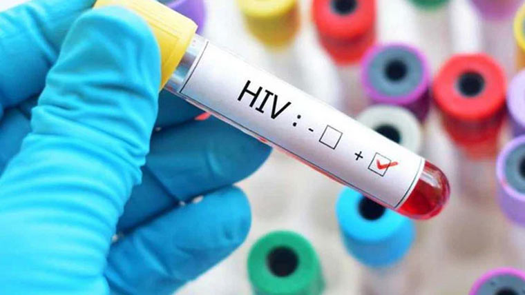 اسلام آباد میں ایچ آئی وی کے 618 نئے کیسز رپورٹ