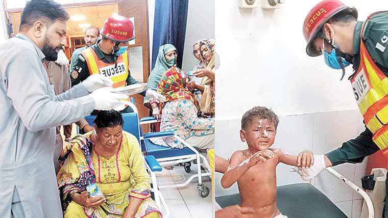 گیس لیکج سے آتشزدگی دوخواتین سمیت 4افراد زخمی 