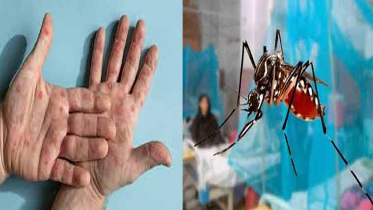 ڈینگی اور منکی پاکس کے حملے متعدد شہری متاثر ہسپتالوں میں انتظامات سخت