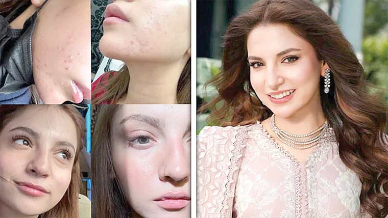  انسان ہوں، ہمیشہ فلٹرز جیسی نظر نہیں آ سکتی:دنانیر 