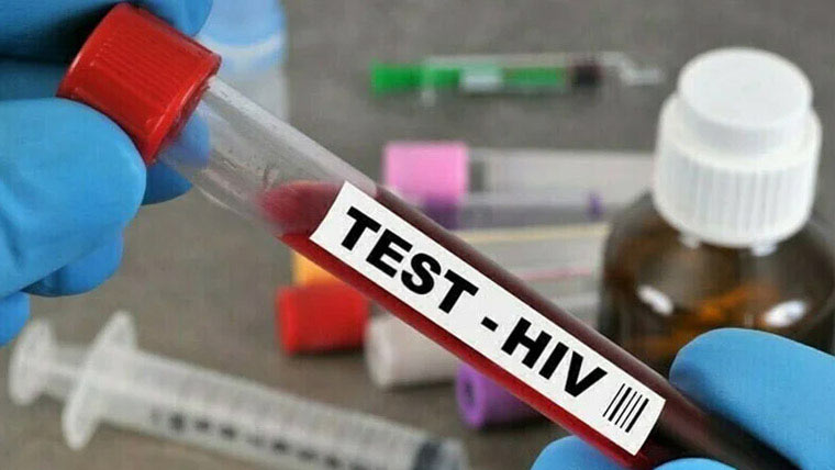  ایچ آئی وی کیسز میں اضافہ،رفتار برقرار رہنے کا خدشہ