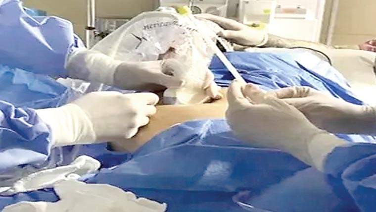  ماں کے پیٹ میں موجود بچے کی کامیاب سرجری 