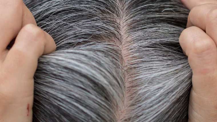 تمباکو نوشی جلدی بال سفید کرنے کی ایک بڑی وجہ 