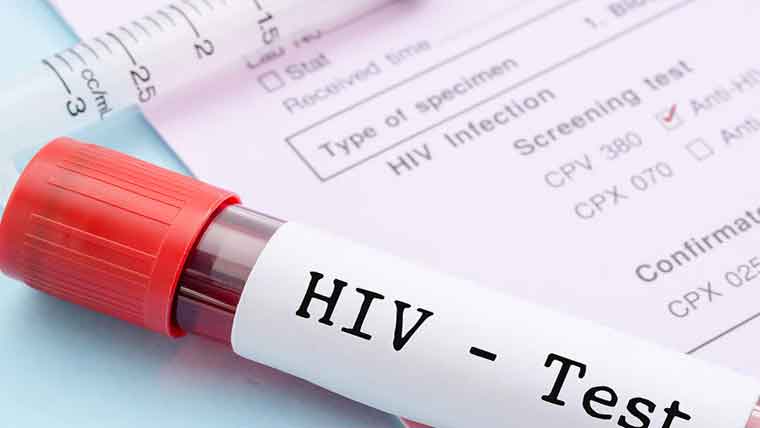  ایچ آئی وی متاثرہ بچوں کے خاندانوں کیلئے مستقل مفت علاج کا مطالبہ