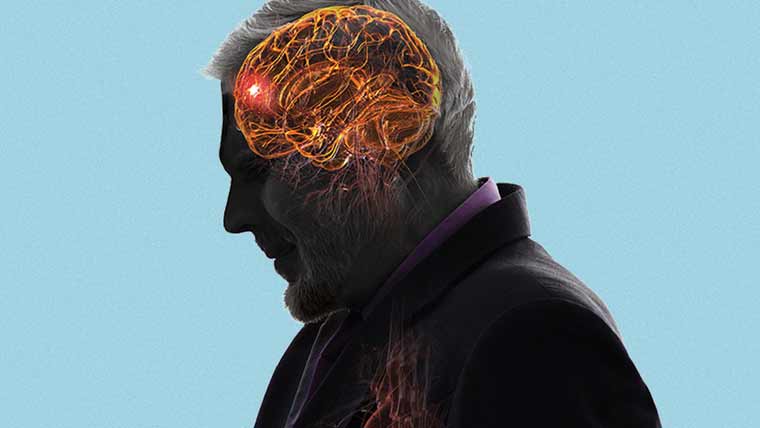 منی سٹروک کی 7علامات جو ہر کسی کو معلوم ہونی چاہئیں