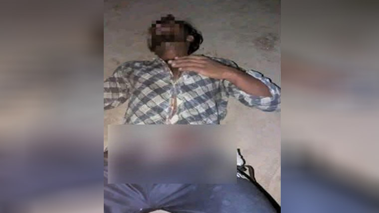  ملزم کے نیفے میں پستول چل  گیا، مردانہ صفات سے محروم