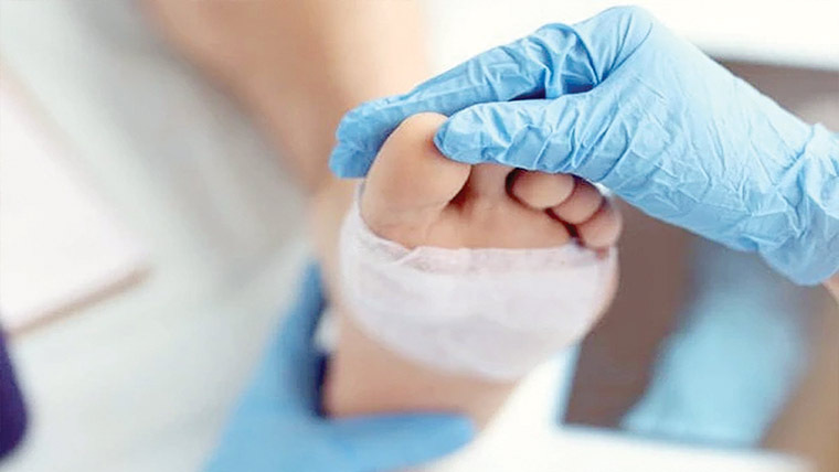 ذیا بیطس کے مریضوں کیلئے انقلابی آکسیجن جیل تیار