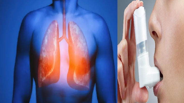 آلودگی سے سانس کی الرجی کے مریض بڑھ گئے