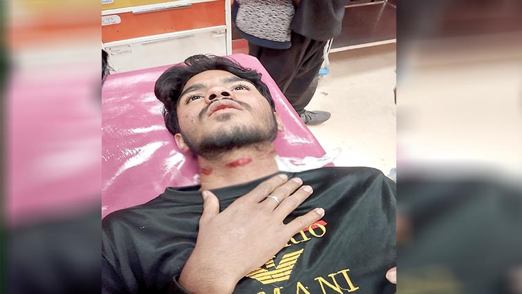 گجومتہ :موٹرسائیکل سوار نوجوان گلے پر ڈور پھرنے سے زخمی 