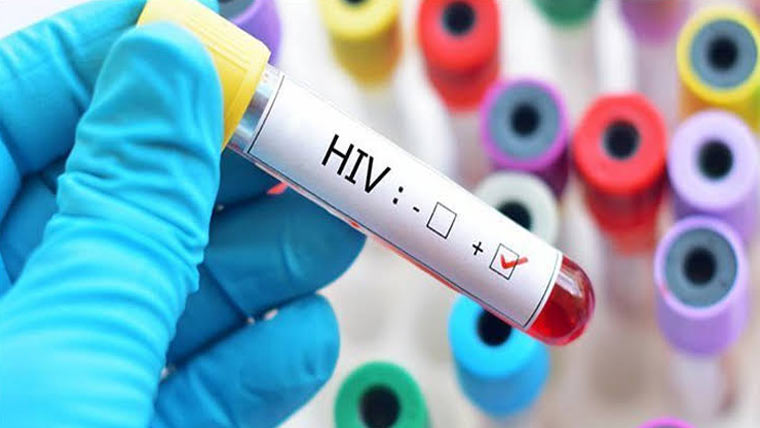 سندھ :رواں برس 6ماہ میں 729 بچوں میں ایچ آئی وی کی تشخیص 