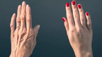  لاشوں کی جِلد کو سدا بہار جوانی کیلئے استعمال کیا جانے لگا