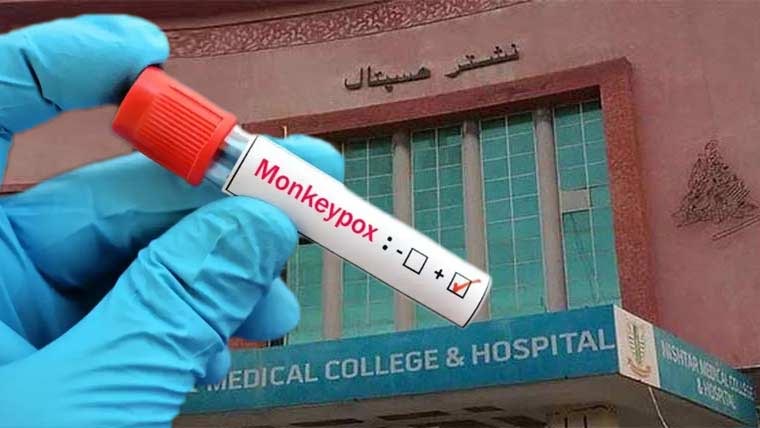 نشتر ہسپتال میں زیر علاج  مریض میں منکی پاکس کی تصدیق 