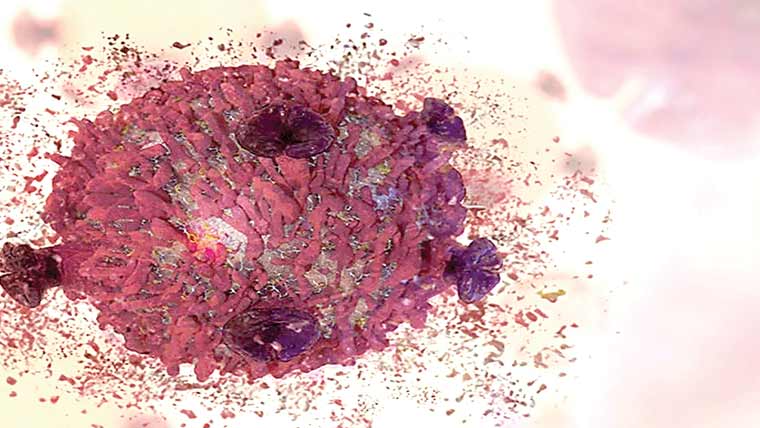 کینسر خلیات سے لڑنے کیلئے نیا آئرن نینو مٹیریل تیار