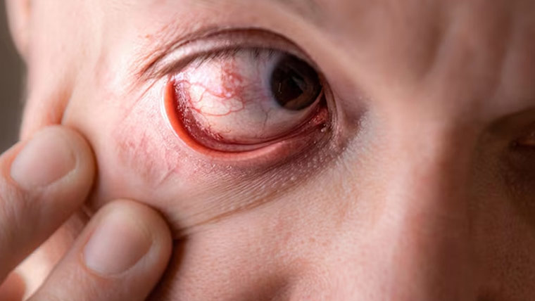 کیا آنکھوں کی ورزش واقعی نظر بہتر کرسکتی ہے ؟ 