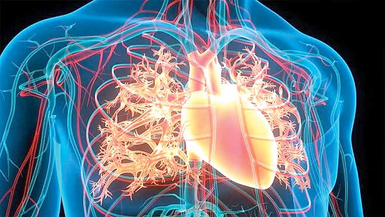 مریضوں کو سٹروک سے بچانے کیلئے نئی تکنیک وضع
