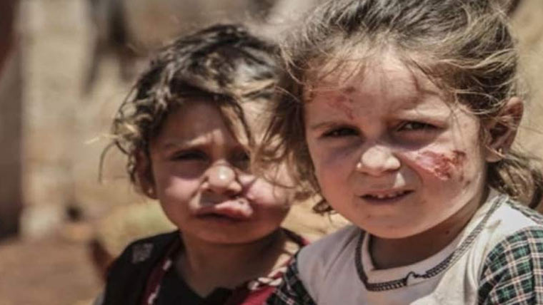 جنوبی وزیرستان:بچوں میں جلد کی  بیماری ، لشمینیا کے 255 مریض 