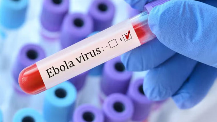  10 ممالک ایبولا وائرس کے خطرے سے دوچار:افریقی یونین 