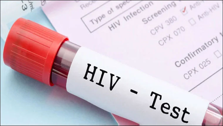  ہسپتا لوں کیلئے HIV،ہیپا ٹائٹس سکریننگ ڈیٹا شیئر کرنا لازم قرار 